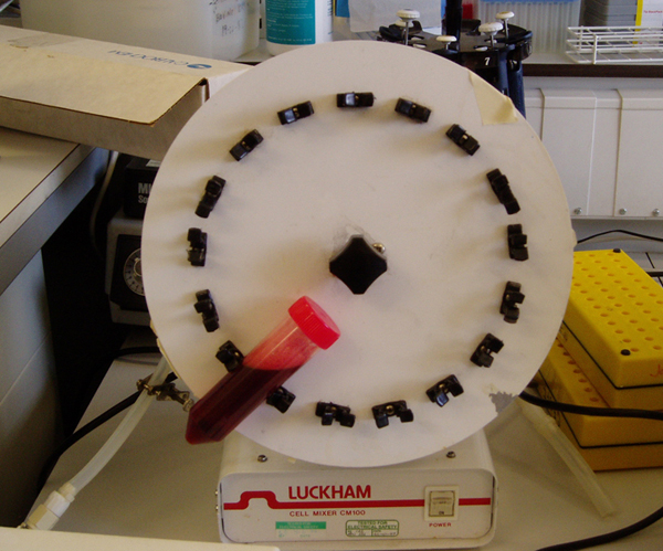 Steve Tanza Stanza dna blood