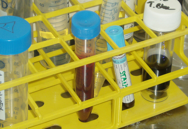 Steve Tanza , Stanza , blood for DNA